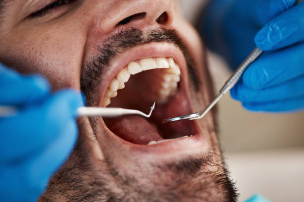Best Emergency Treatment for Dental Infections or Abscesses in Leesport, PA